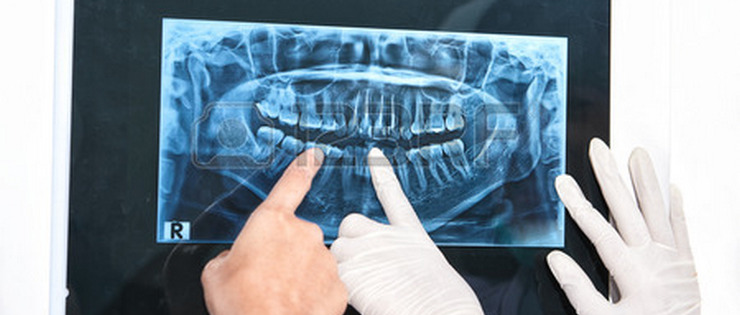 Dental Health Article by Dr Emma - "X-ray Safety" 
