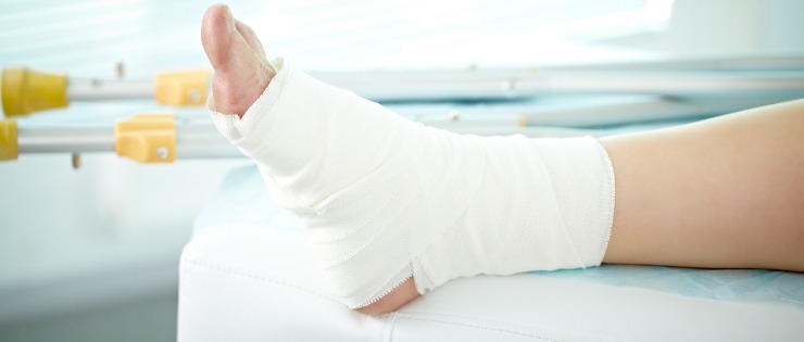 A person's foot elevated with a bandage after following the steps of RICER for soft tissue injuries (in this case a sprained ankle)