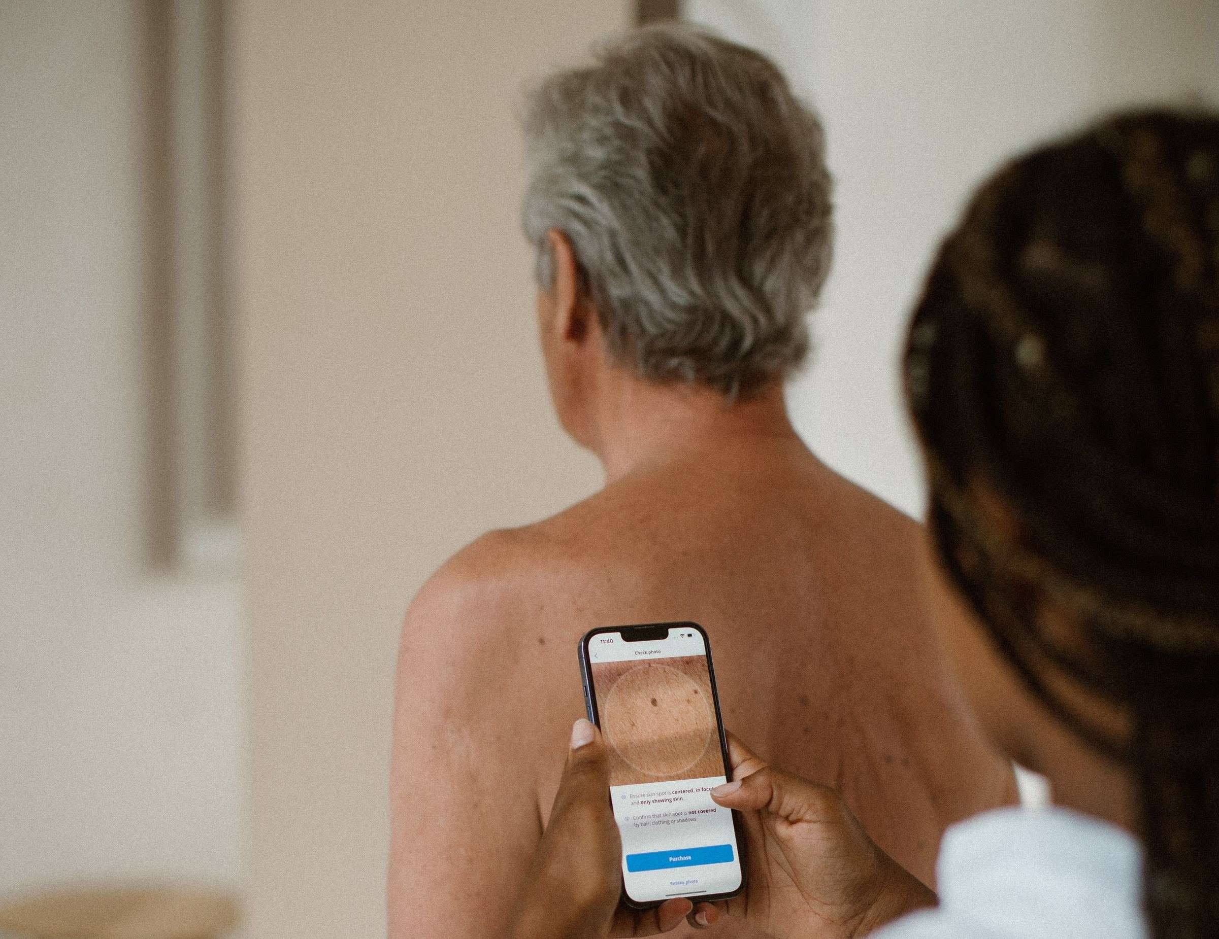 West Australians are putting off skin cancer screenings