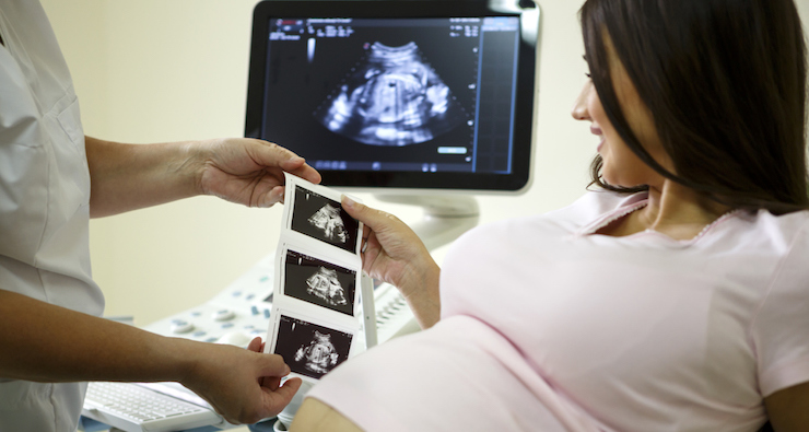 expectant mother going for ultrasound